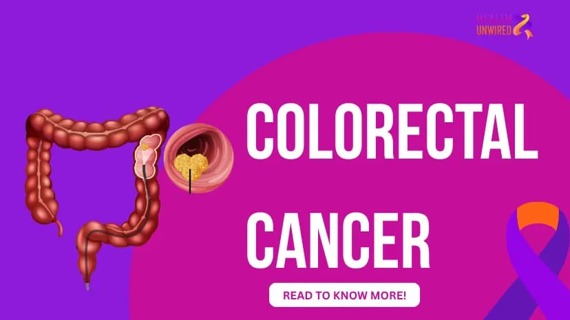 Colorectal Cancer
