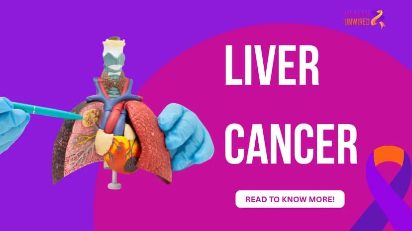Liver Cancer