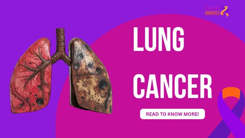 Lung Cancer