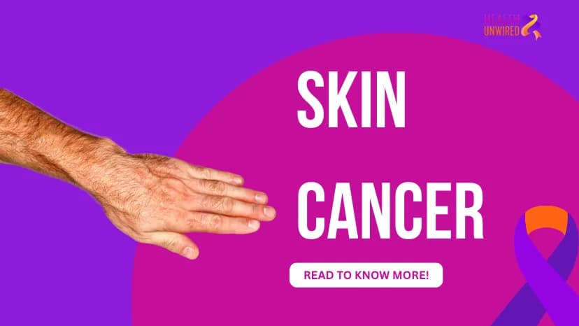 Skin Cancer