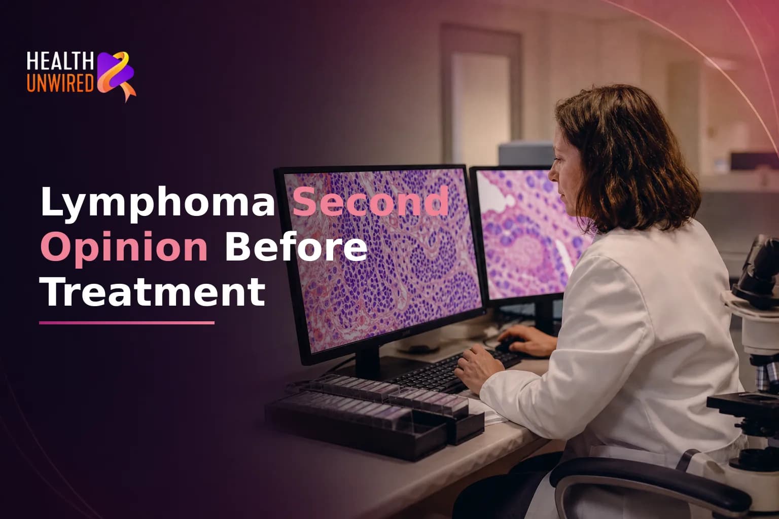Getting a Second Opinion Before Lymphoma Treatment