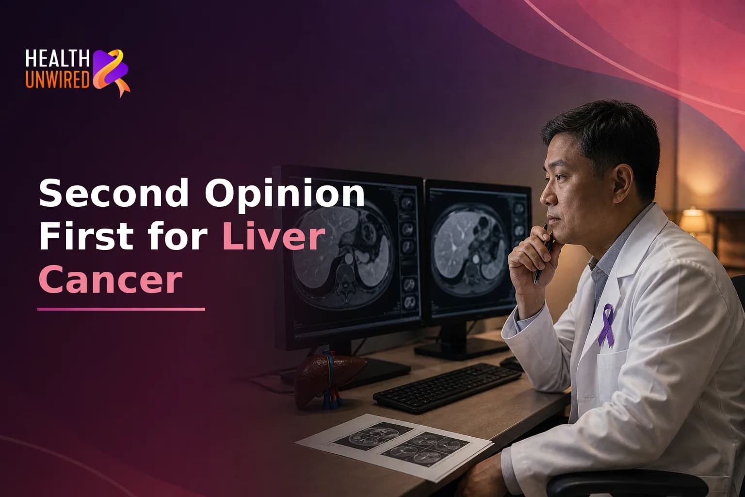 Why You Should Get a Second Opinion for Liver Cancer